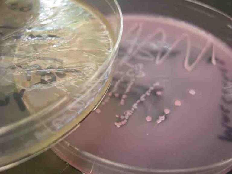 Bacterial Growth on MacConkey's Agar. Lac - Salmonella Left, Lac + E.coli Right