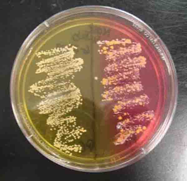 Nasal Swab Sample Mannitol Salt Agar (MSA). Non-mannitol Fermenter Left. Mannitol Fermenter Right