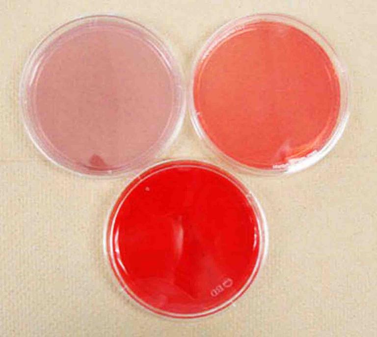 Sterile MacConkey's Agar, Mannitol Salt Agar & Blood Agar