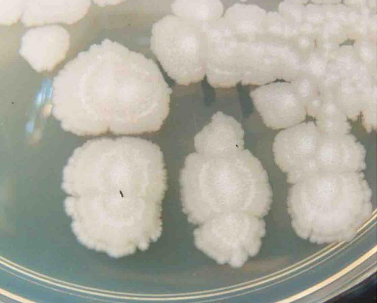 ​ Bacillus subtilis  bacterial colonies grown on TSY agar