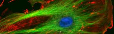 Fluoresced Eukaryotic Cell, NIH