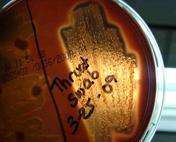 Blood Agar Bacterial Growth Medium Showing Beta Hemolysis