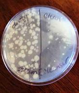 TSY agar with samples from kitchen floor before and after cleaning with Shark® PRO Steam & Spray™ Mop using both steam and cleanser.