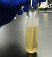 Mycobacterium smegmatis growing on the surface of hte media, forming a pellicle (film on the surface of the media and and interior of the test tube, a biofilm at the liquid / air interface.