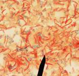 Stain of endospore-producing Bacillus subtilis: Endospores green, vegetative cells red.