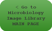 Go to Microbiology Image Library MAIN PAGE