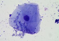 Human Cheek Cell (eukaryotic) and Oral Bacteria (prokaryotic)