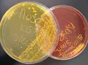 Mannitol Salt Agar