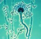 Aspergillus fumigatus Fungus