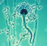 Aspergillus fumigatus Fungus