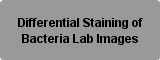 Differential Staining of Bacteria Lab Images